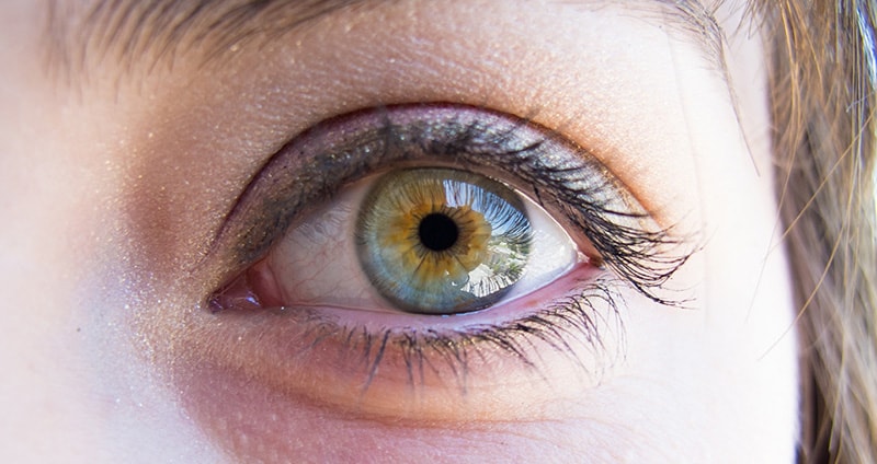 Central Heterochromia – Reasons, Possibility and its Types 33