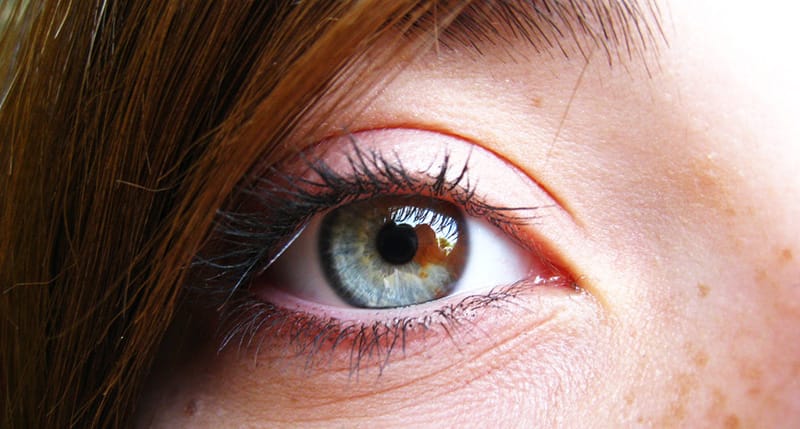 Central Heterochromia – Reasons, Possibility and its Types 36