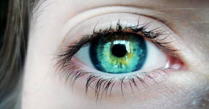 Central Heterochromia – Reasons, Possibility and its Types 35