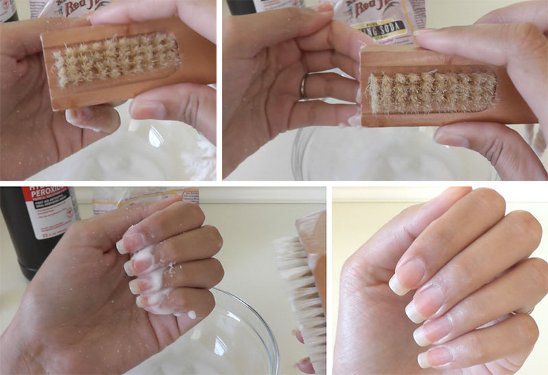 How to Get Rid of Yellow Nails at Home by these Easy Steps - upsmash