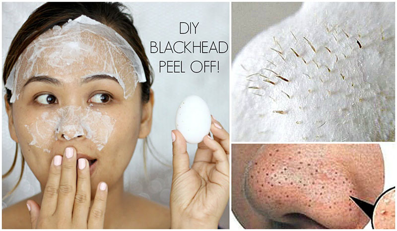 10 Amazing DIY Face Mask Recipes for all Types of Skin 26