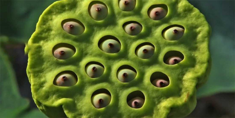 Trypophobia and its Causes –How Do You Get Trypophobia? 5